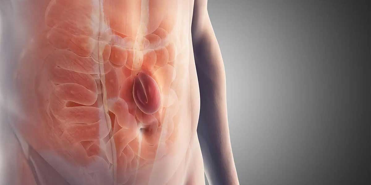 Symptoms of Failed Hernia