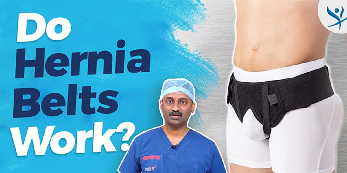 Do Hernia Belts Work