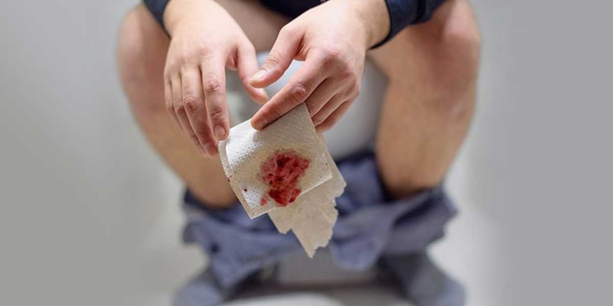 8 Harmless Habits you didn't know can Cause Piles