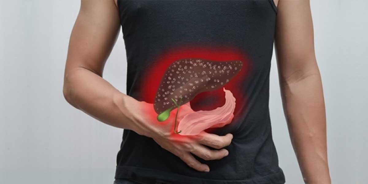 Top 5 Common myths of Fatty Liver