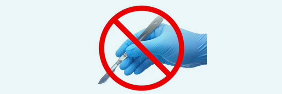 Why you Should opt for Laser Treatment for Piles