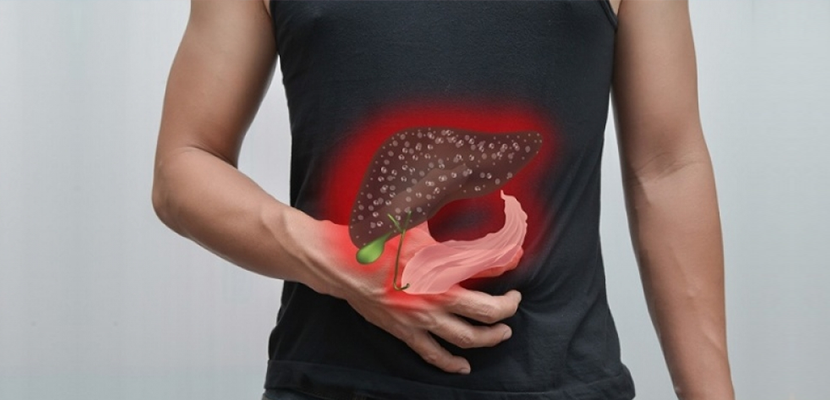 Top 5 Common myths of Fatty Liver