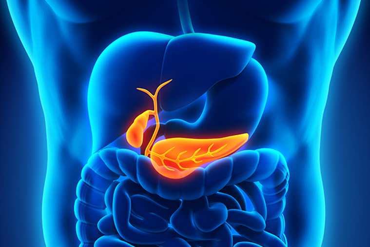 Bile Duct Cancer