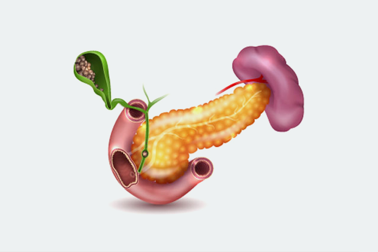 Gall Bladder Cancer