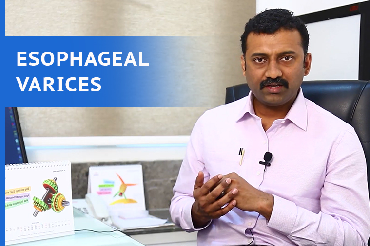 Esophageal Varices Treatment in Hyderabad Esophageal Varices Treatment in Hyderabad