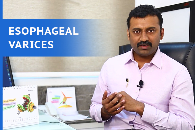 Esophageal Varices Treatment in Hyderabad