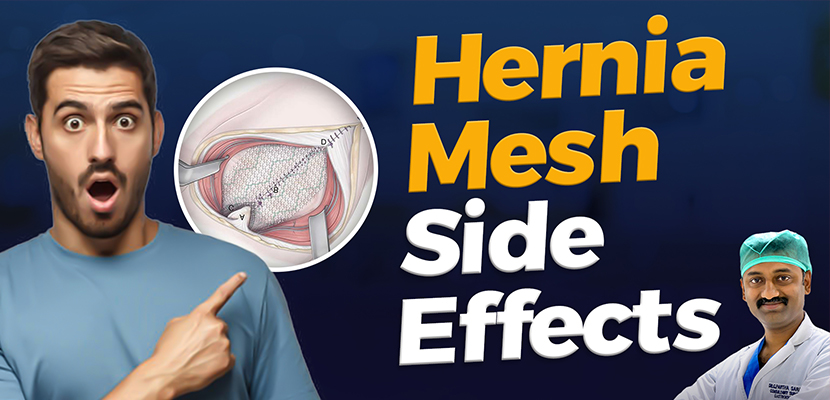 Hernia Mesh Side Effects – Hernia Mesh Failure Signs, Symptoms & Treatment