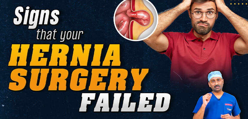 Failed Hernia Surgery Symptoms Signs That Your Hernia Repair Failed